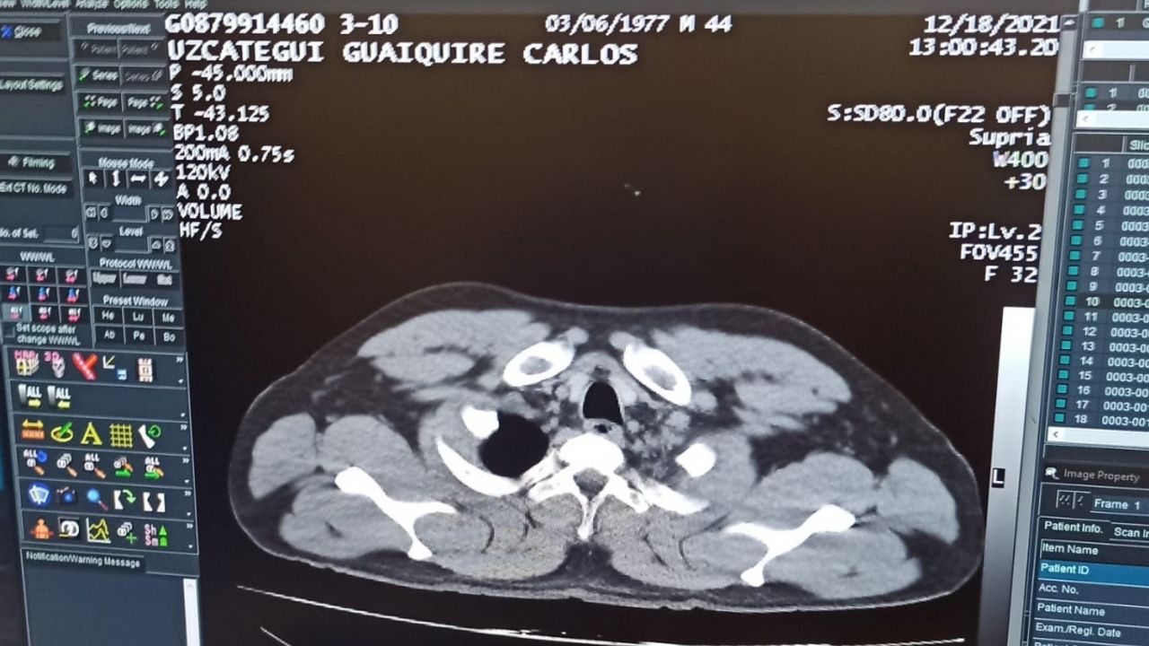 İstanbul Havalimanı'nda uyuşturucu kuryesi yakalandı